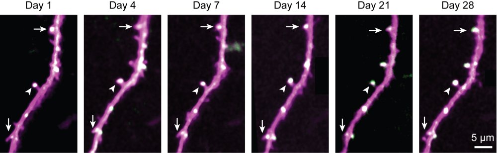 Proteine di lunga durata indicano come durano una vita i ricordi