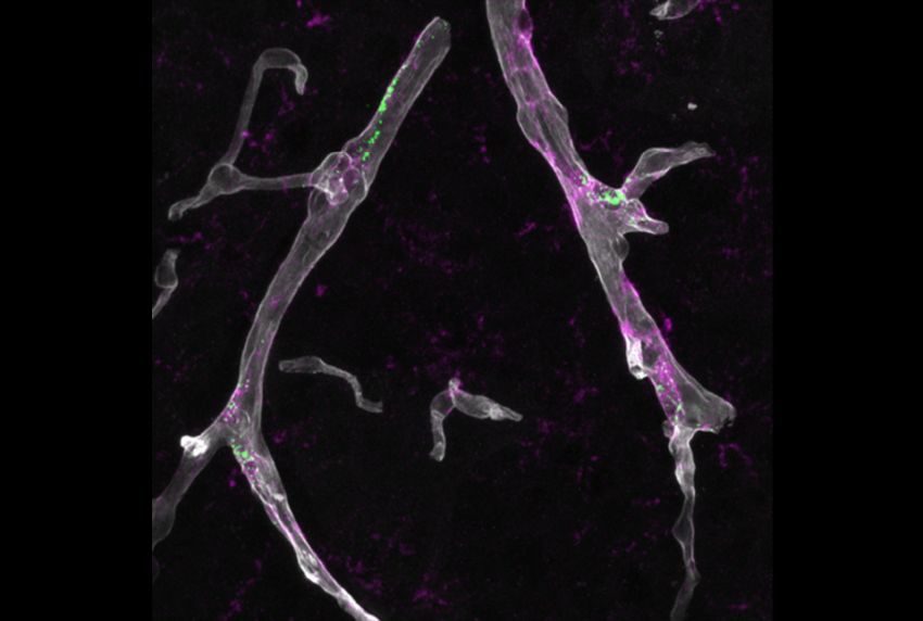 macrophages green ApoE4 magenta blood microvessels gray