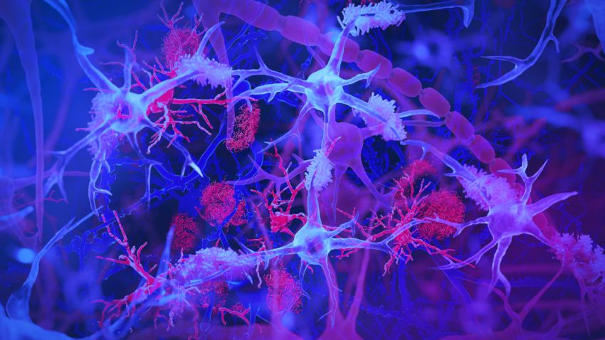 microglia lightbluepurple interacting with amyloid plaques red by Jason Drees ASU