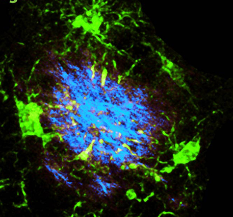 Identificato nuovo obiettivo nella lotta all'Alzheimer e alla sclerosi multipla