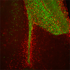 Trovata altra area del cervello che può produrre nuovi neuroni