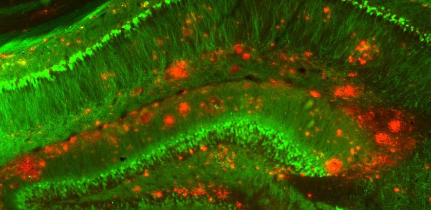 mouse model of alzheimers disease