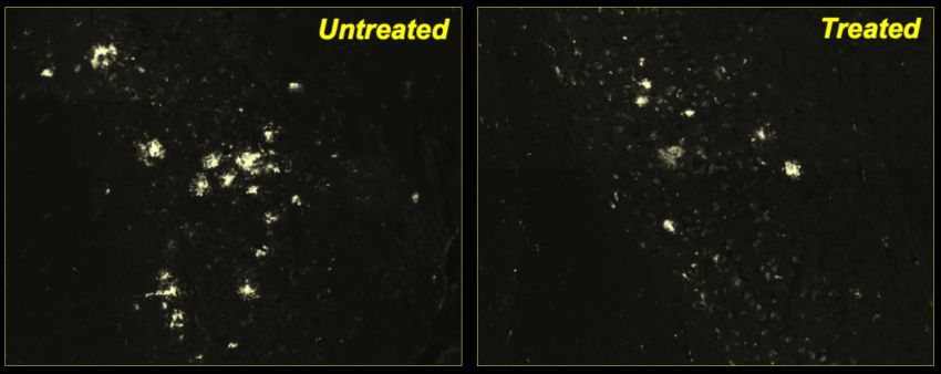 mouse model of alzheimers treated with the drug ca