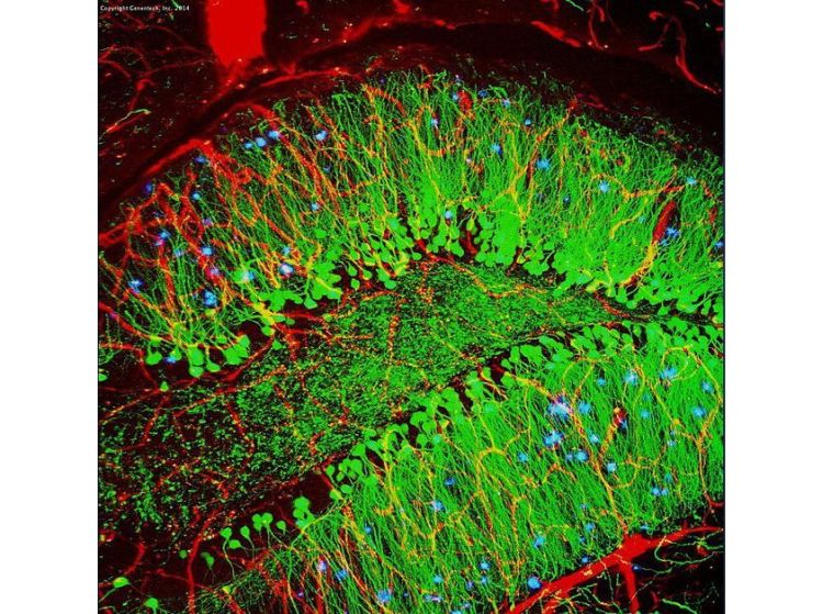 mouse brain with blood vessels (red), brain cells (green), amyloid plaques (blue) 