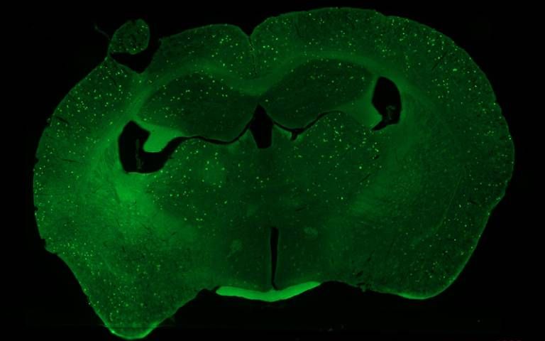 mouse brain by Sarah Shipley UCL