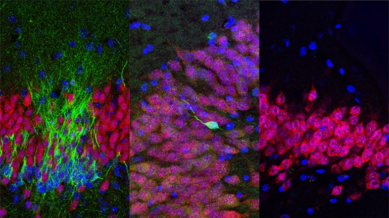 La nascita di nuovi neuroni nell'ippocampo umano finisce nell'infanzia