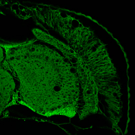 C'è una nuova strada per la lotta alle malattie neurodegenerative?