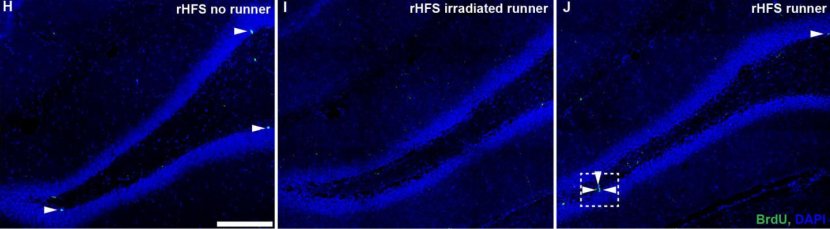 Neurogenesi: la nascita di nuovi neuroni è favorita dall'esercizio fisico