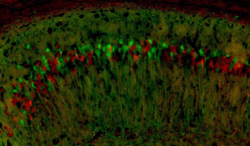 neurons expressing x chromosomes by A Moreno UCSF