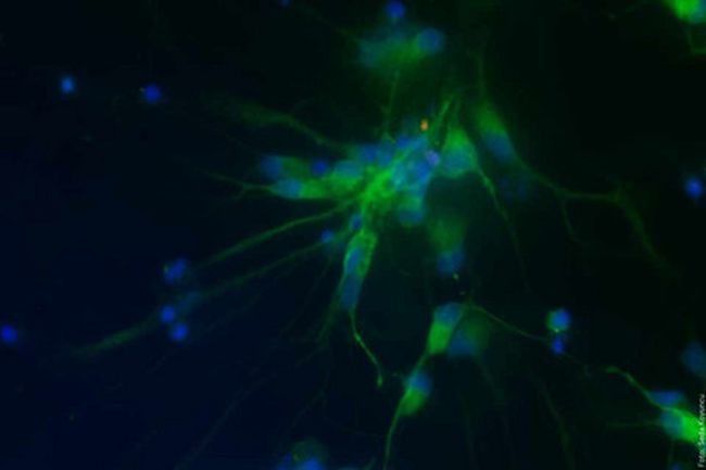 neuroprotective effect of USP4 knockdown in iPSC derived motor neurons