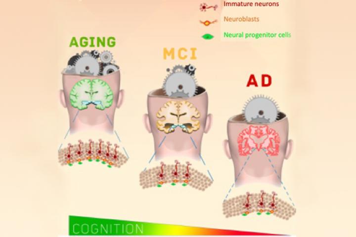 new neurons with mci and alzheimer