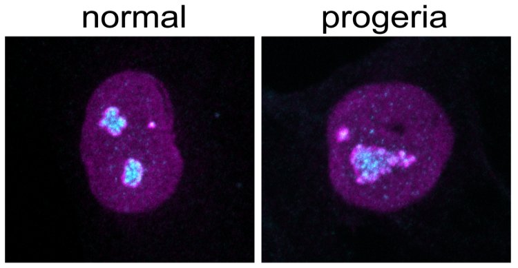 Il ricambio di proteine può essere la chiave per vivere più a lungo