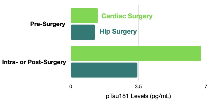 pTau181 levels pre intra post surgery