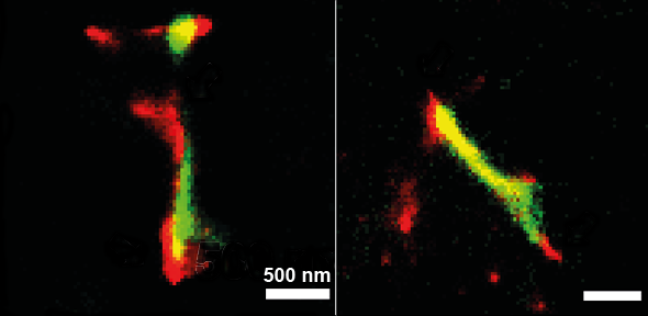 Ricercatori vedono il momento in cui le proteine del Parkinson diventano tossiche