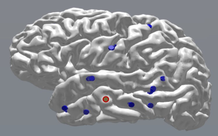 La stimolazione elettrica cerebrale con tempi precisi migliora la memoria