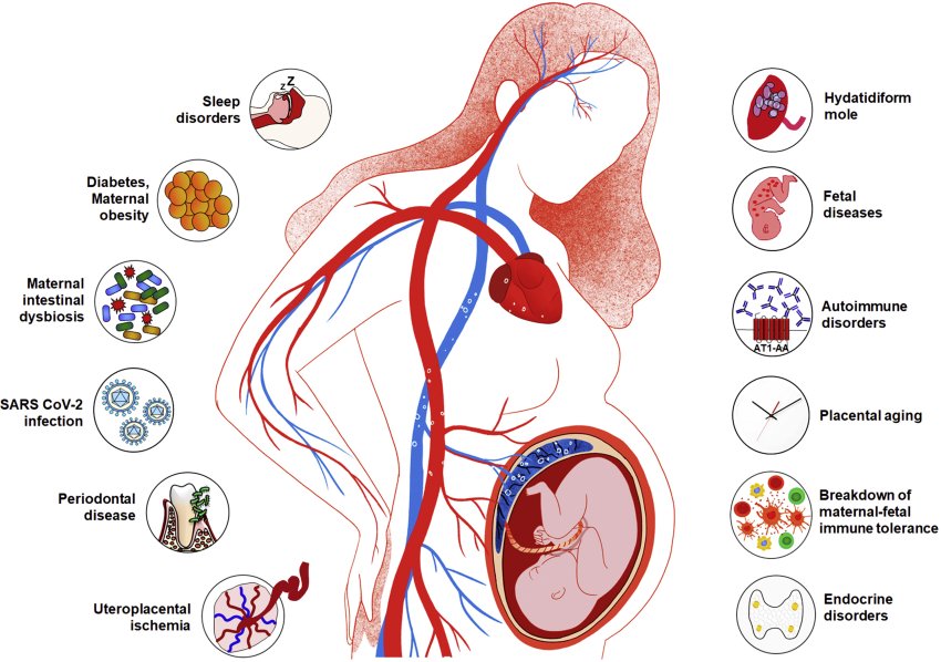 preeclampsia etiology