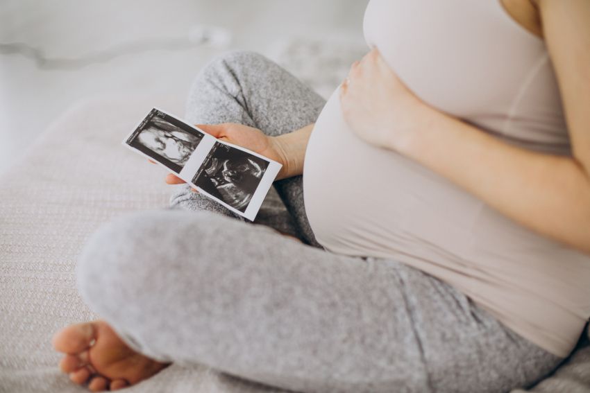 pregnant woman with ultrasound photo 