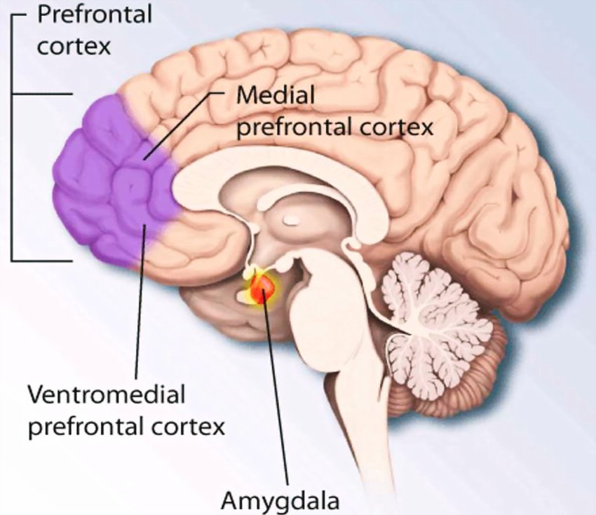 Alcuni pazienti con demenza possono sperimentare PTSD a insorgenza ritardata