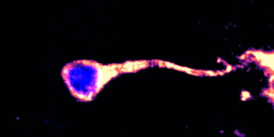 quiescent neural stem cell by Duke NUS