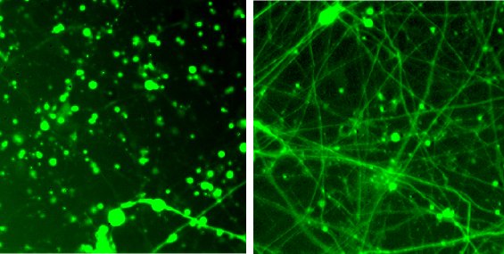 Ridurre il consumo energetico dei neuroni per trattare le neurodegenerazioni