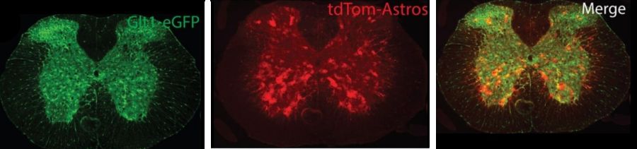 red astrocytes in the spine of a mouse