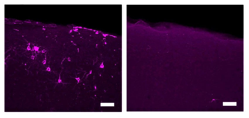 reduced tau phosphorylation by tactile 40hz stimulation MIT