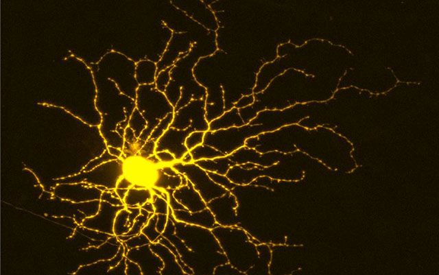 retinal ganglion cell Huberman