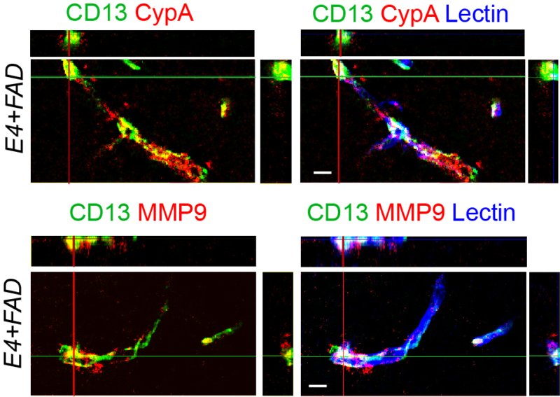 role of apoe4 on alzheimer