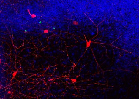 running neuron study