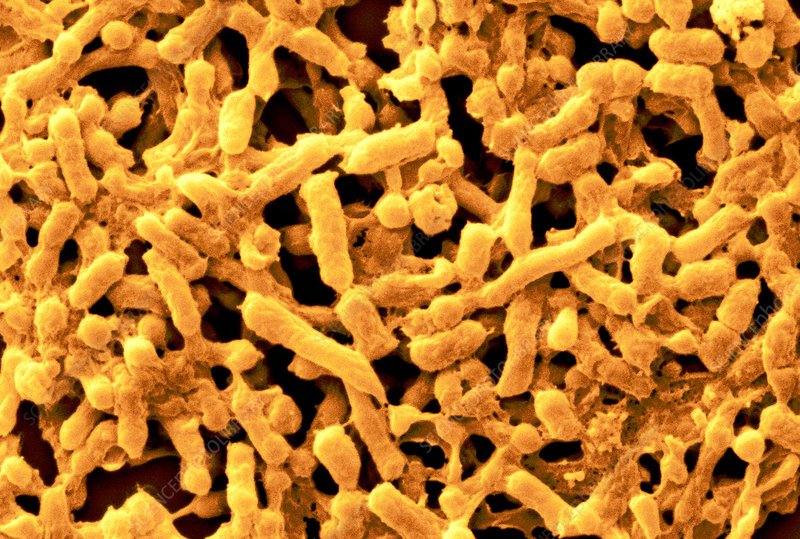 salmonella biofilm science photo