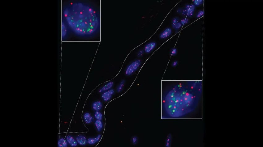 senescent skin cells