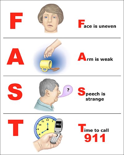 signs-of-a-stroke