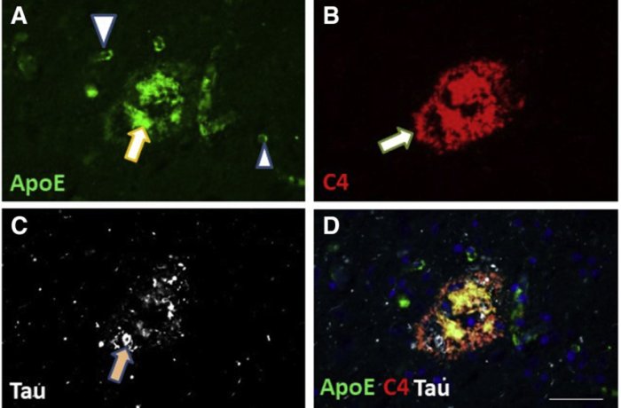 study-now-links-non-mutated-apoe-to-dementia-in-the-aging-brain.jpg