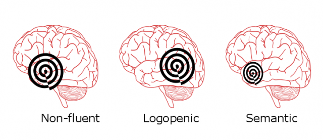 subtypes of primary progressive aphasia