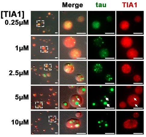 tau droplets inside TIA1 bigger droplets