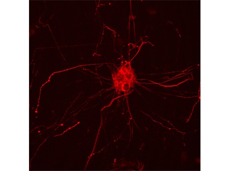 Modulare il colesterolo nel cervello: può essere utile per l'Alzheimer?