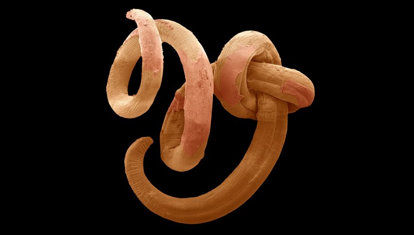 threadworm sem spl