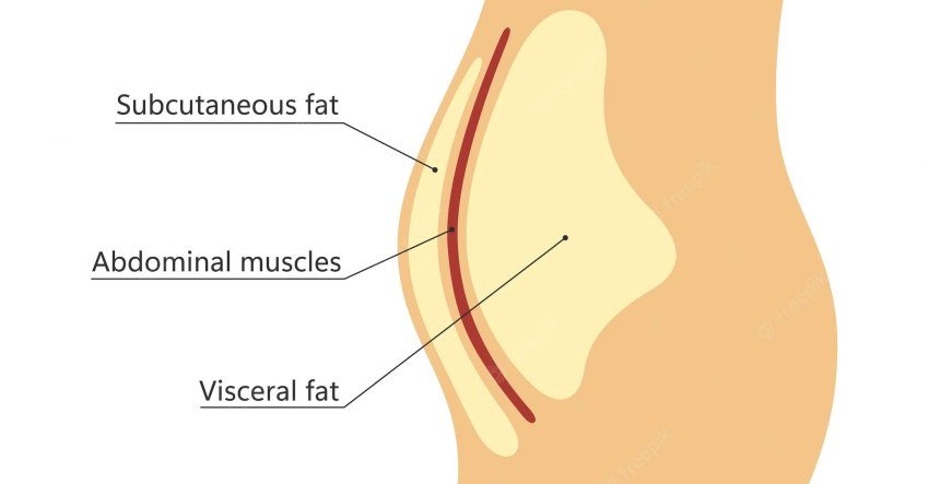 visceral subcutaneous abdominal fat