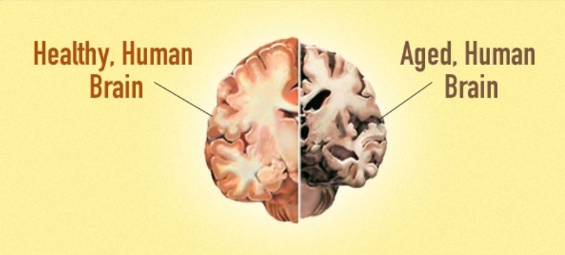 young versus old brain